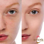 نتایج استفاده از کرم پودر نارس