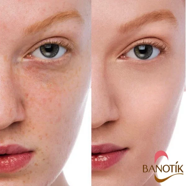 نتایج استفاده از کرم پودر نارس