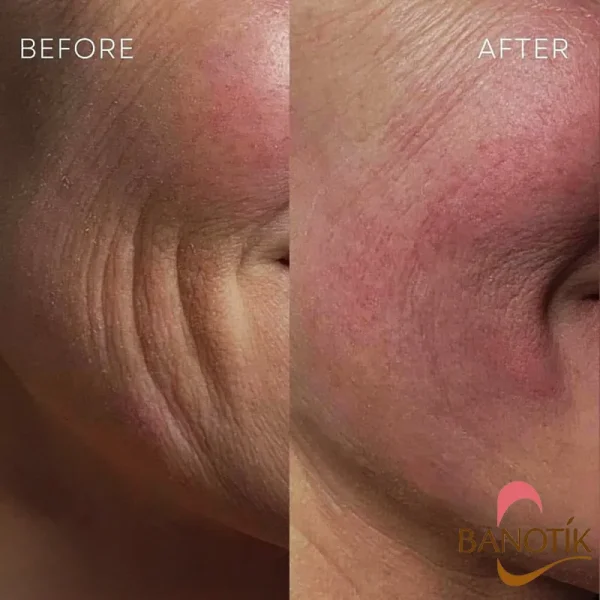 نتایج استفاده بوستر کوزارکس