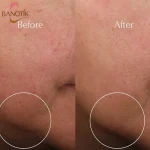 نتیجه ی استفاده از کرم سوپریم جوانساز استی لادر