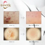 نتایج استفاده از سرم ریدل شات 300 وی تی