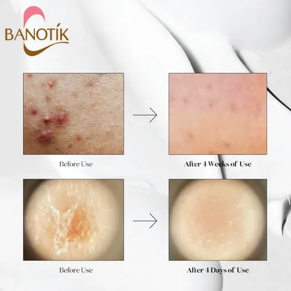 نتایج استفاده از سرم ریدل شات 300 وی تی