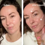 تونر شیر ساکارومایسس اوردینری - Image 12