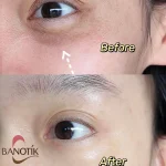 نتایج استفاده از کرم دور چشم استی لادر