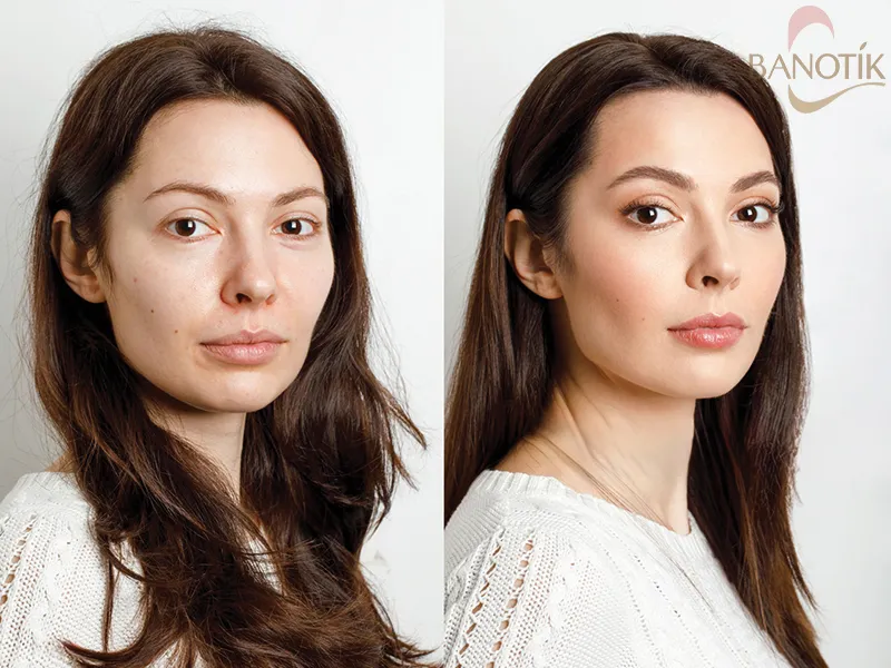 انتخاب رنگ کانسیلر برای خطوط ریز و چینوچروک