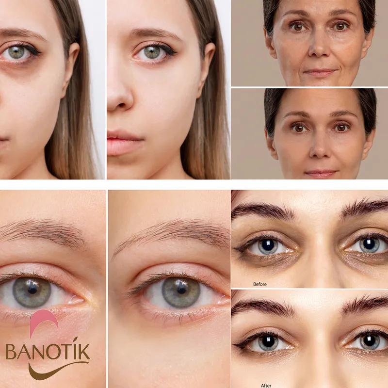 نتایج استفاده از کرم دور چشم بیوتی آف جوسان