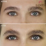 قبل و بعد استفاده از سرم تقویت مژه اوردینری