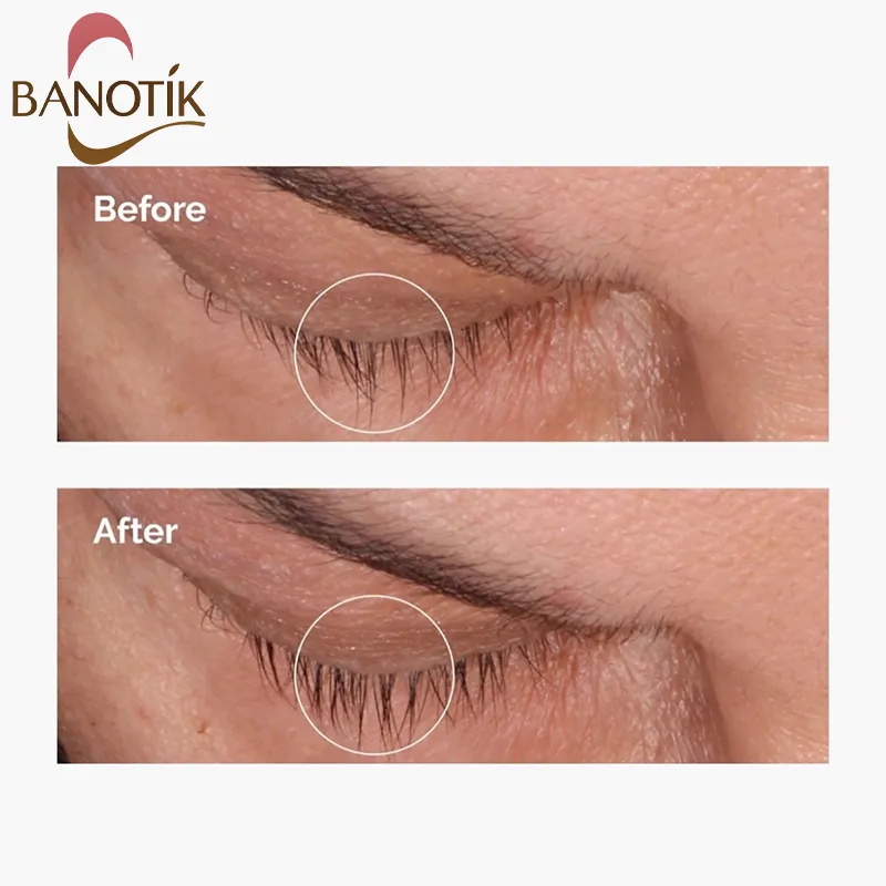 نظرات درباره تقویت مژه اوردینری