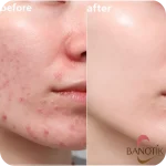 سرم نیاسینامید + زینک اوردینری - تصویر 10