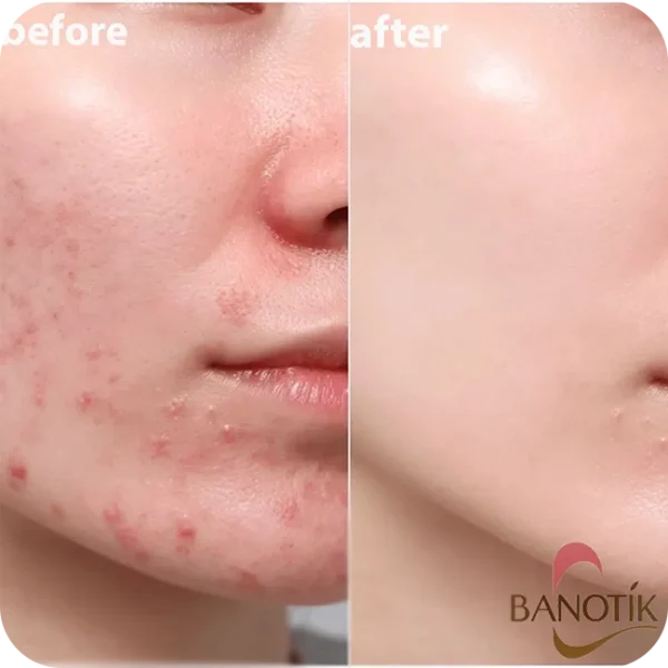 سرم نیاسینامید + زینک اوردینری - تصویر 10